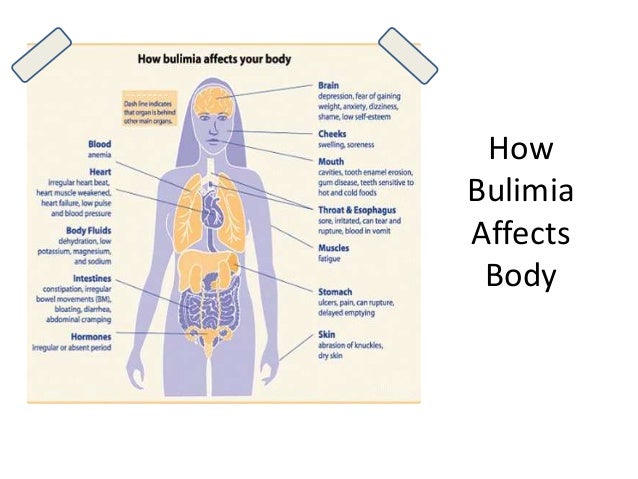 bulimia mani bulimia mani